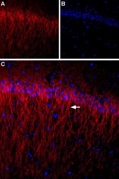 Expression of CACNB1 (CaVβ1) in rat hippocampus