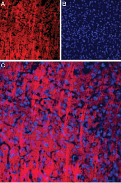 Expression of P2RX2 in rat brain