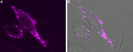 Expression of TRPV3 in rat PC12 cells