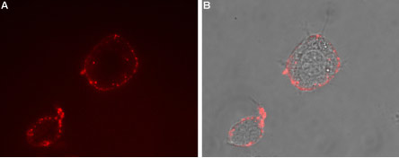 Expression of TRPV3 in rat PC12 cells