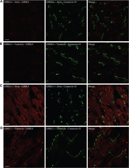Anti-KCNJ5 (Kir3.4) Antibody Anti-KCNJ5 (Kir3.4) Antibody