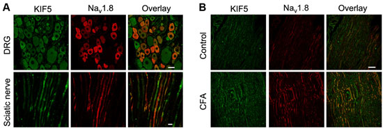 Anti-Nav1.8 (SCN10A) Antibody Anti-Nav1.8 (SCN10A) Antibody