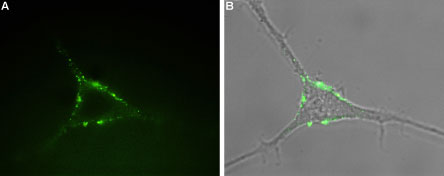 Expression of P2RY1 in rat PC12 cells