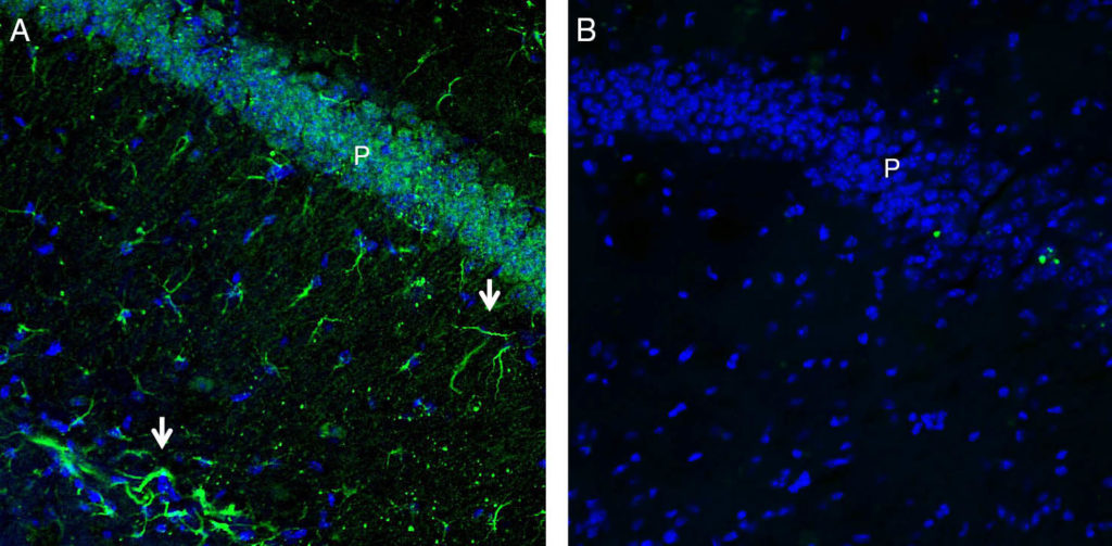 Expression of GPR43/FFAR2 in mouse hippocampus.