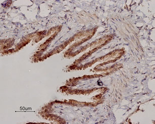 Expression of β2-Adrenoceptor in rat lung