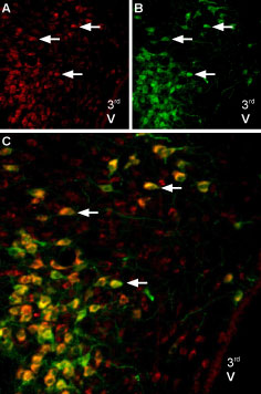 Anti-Angiotensin II Receptor Type-2 (extracellular)-ATTO Fluor-488 Antibody Anti-Angiotensin II Receptor Type-2 (extracellular)-ATTO Fluor-488 Antibody