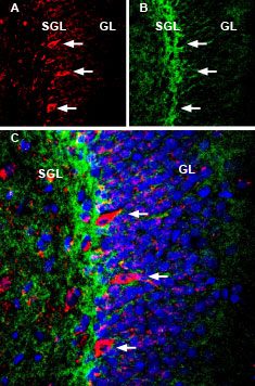 Anti-ASCT1 (SLC1A4) Antibody