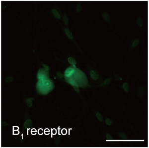 Anti-B1 Bradykinin Receptor (BDKRB1) Antibody