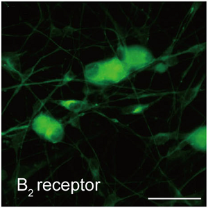 Anti-B2 Bradykinin Receptor (BDKRB2) Antibody Anti-B2 Bradykinin Receptor (BDKRB2) Antibody