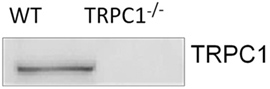 Anti-TRPC1 Antibody Anti-TRPC1 Antibody