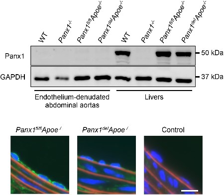 Anti-Pannexin 1 Antibody