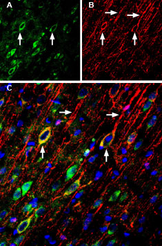 Anti-SynGAP Antibody Anti-SynGAP Antibody