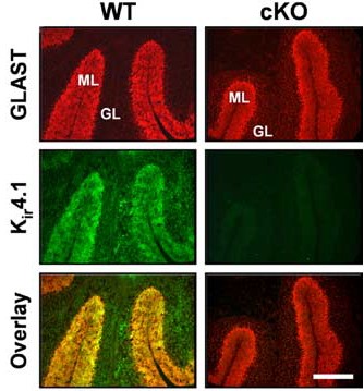 Anti-Kir4.1 (KCNJ10) Antibody Anti-Kir4.1 (KCNJ10) Antibody