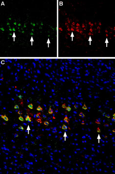 Anti-Nicotinic Acetylcholine Receptor β2 (CHRNB2) (extracellular)-ATTO Fluor-594 Antibody