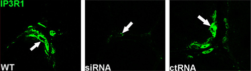 Anti-IP3 Receptor-1 (ITPR1) Antibody Anti-IP3 Receptor-1 (ITPR1) Antibody