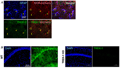 Anti-KCNK2 (TREK-1) Antibody Anti-KCNK2 (TREK-1) Antibody