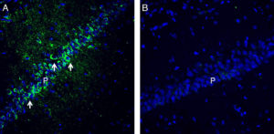 Expression of PACSIN1 in rat hippocampus. 