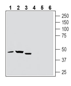 Western blot analysis of rat spleen lysate (lanes 1 and 4), rat brain lysate (lanes 2 and 5) and mouse brain lysate (lanes 3 and 6):