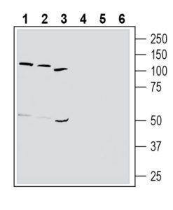 Western blot analysis of human K562 chronic myelogenous leukemia cell line lysate (lanes 1 and 4), human HL-60 promyelocytic leukemia cell line lysate (lanes 2 and 5) and human MEG-01 megakaryoblastic leukemia cell line lysate (lanes 3 and 6):