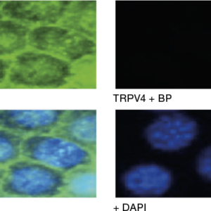 Immunocytochemical staining using Anti-TRPV4 Antibody (ACC-034) within the presence or absence of blocking peptide.